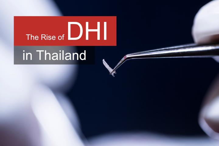 dhi hair transplant in thailand
