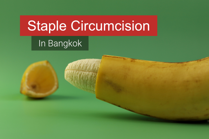 staple circumcision in bangkok